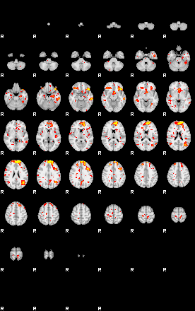 Patient:48;component:155