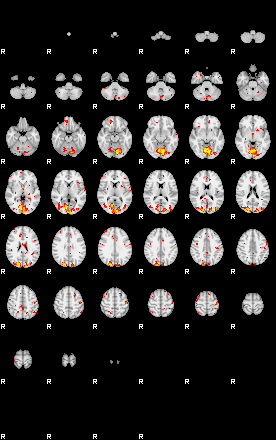 Patient:48;component:191