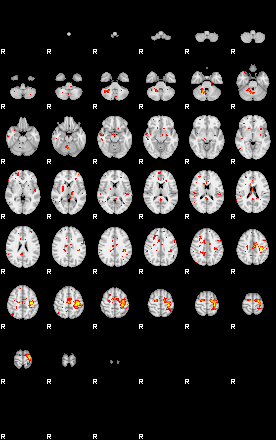 Patient:48;component:21