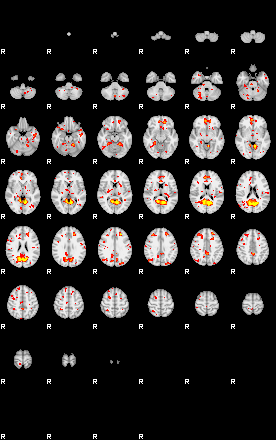 Patient:48;component:5