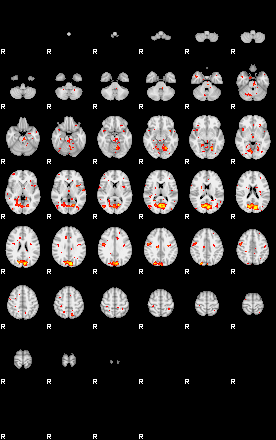 Patient:48;component:53