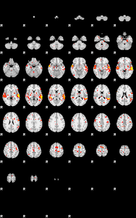 Patient:48;component:56