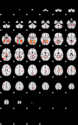 Patient:48;component:69