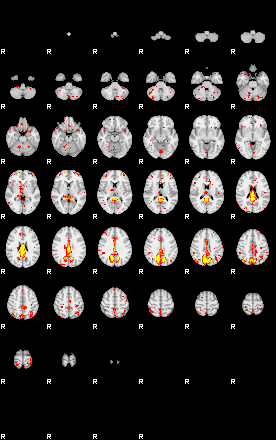 Patient:48;component:74