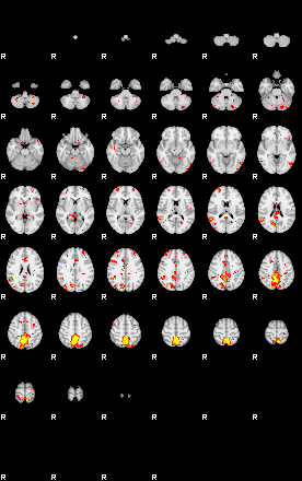 Patient:48;component:84