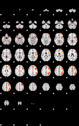 Patient:48;component:94