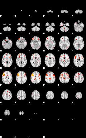 Patient:49;component:119