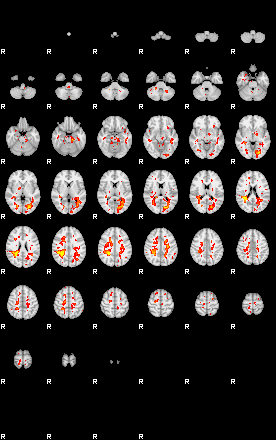 Patient:49;component:121