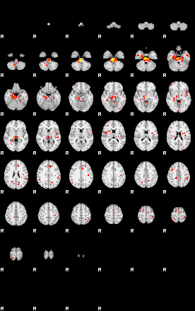 Patient:49;component:124