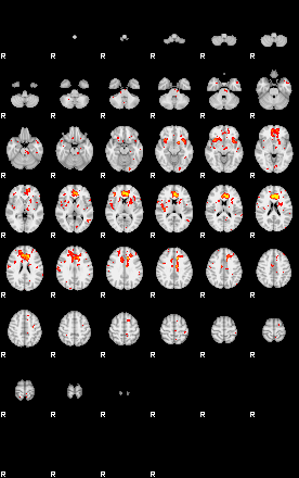 Patient:49;component:125