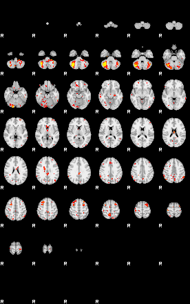 Patient:49;component:130