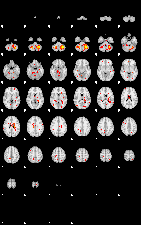 Patient:49;component:135