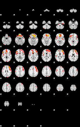 Patient:49;component:144