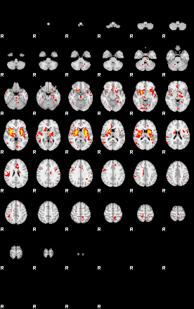 Patient:49;component:158