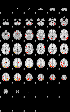 Patient:49;component:182