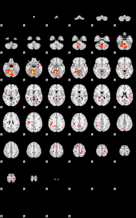 Patient:49;component:198