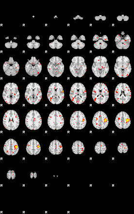 Patient:49;component:21