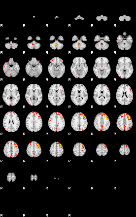 Patient:49;component:33