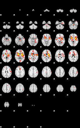 Patient:49;component:39