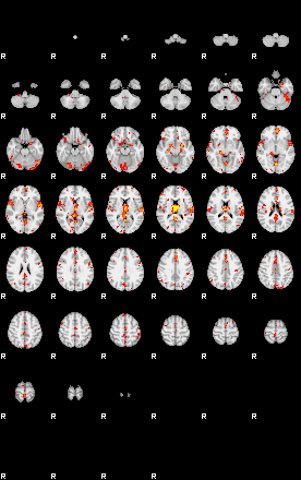 Patient:49;component:47