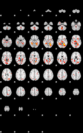 Patient:49;component:69