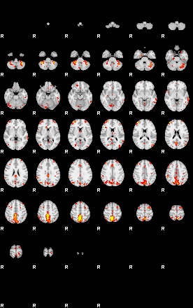 Patient:49;component:84