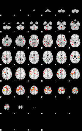 Patient:49;component:92