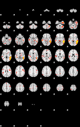 Patient:50;component:10