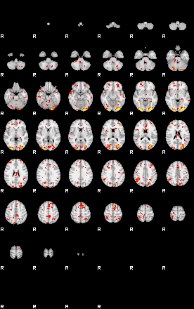 Patient:50;component:111