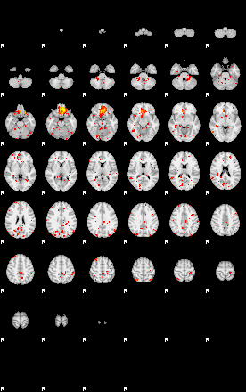 Patient:50;component:113