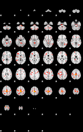 Patient:50;component:115