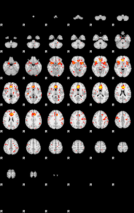 Patient:50;component:125