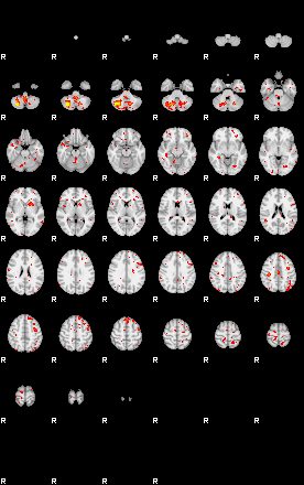 Patient:50;component:130