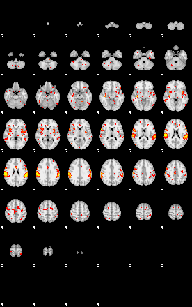 Patient:50;component:150