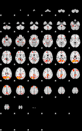 Patient:50;component:183