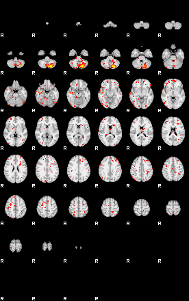 Patient:50;component:19