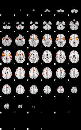 Patient:50;component:195