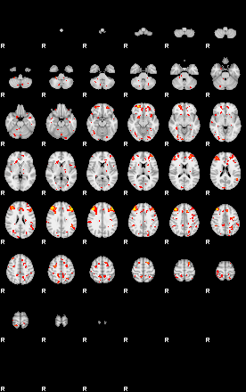 Patient:50;component:25