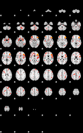 Patient:50;component:42