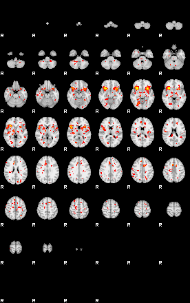 Patient:50;component:46