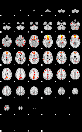 Patient:50;component:49