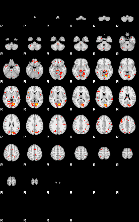 Patient:50;component:53