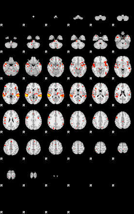 Patient:50;component:56