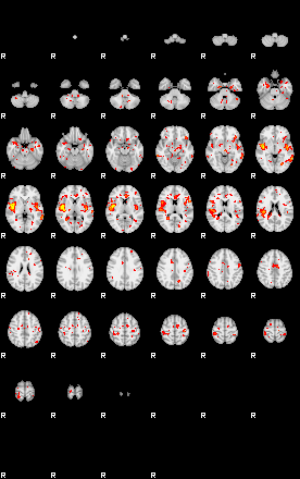 Patient:50;component:58