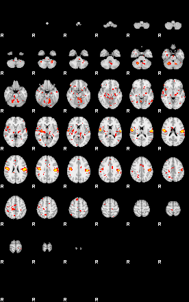 Patient:50;component:71