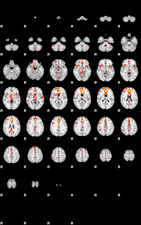 Patient:51;component:105