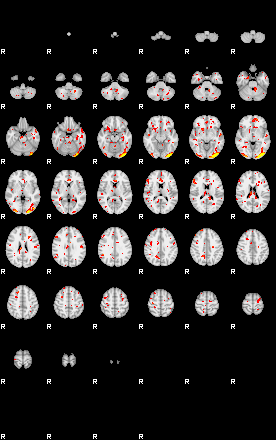 Patient:51;component:111