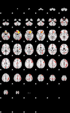 Patient:51;component:113