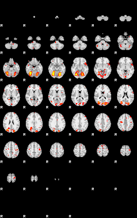 Patient:51;component:126