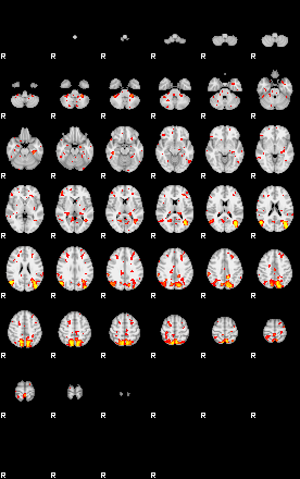 Patient:51;component:142